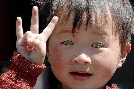 Viral cat-eye story image